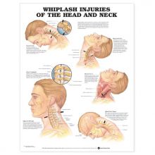 Whiplash Injuries of the Head and Neck Anatomical Chart, Paper